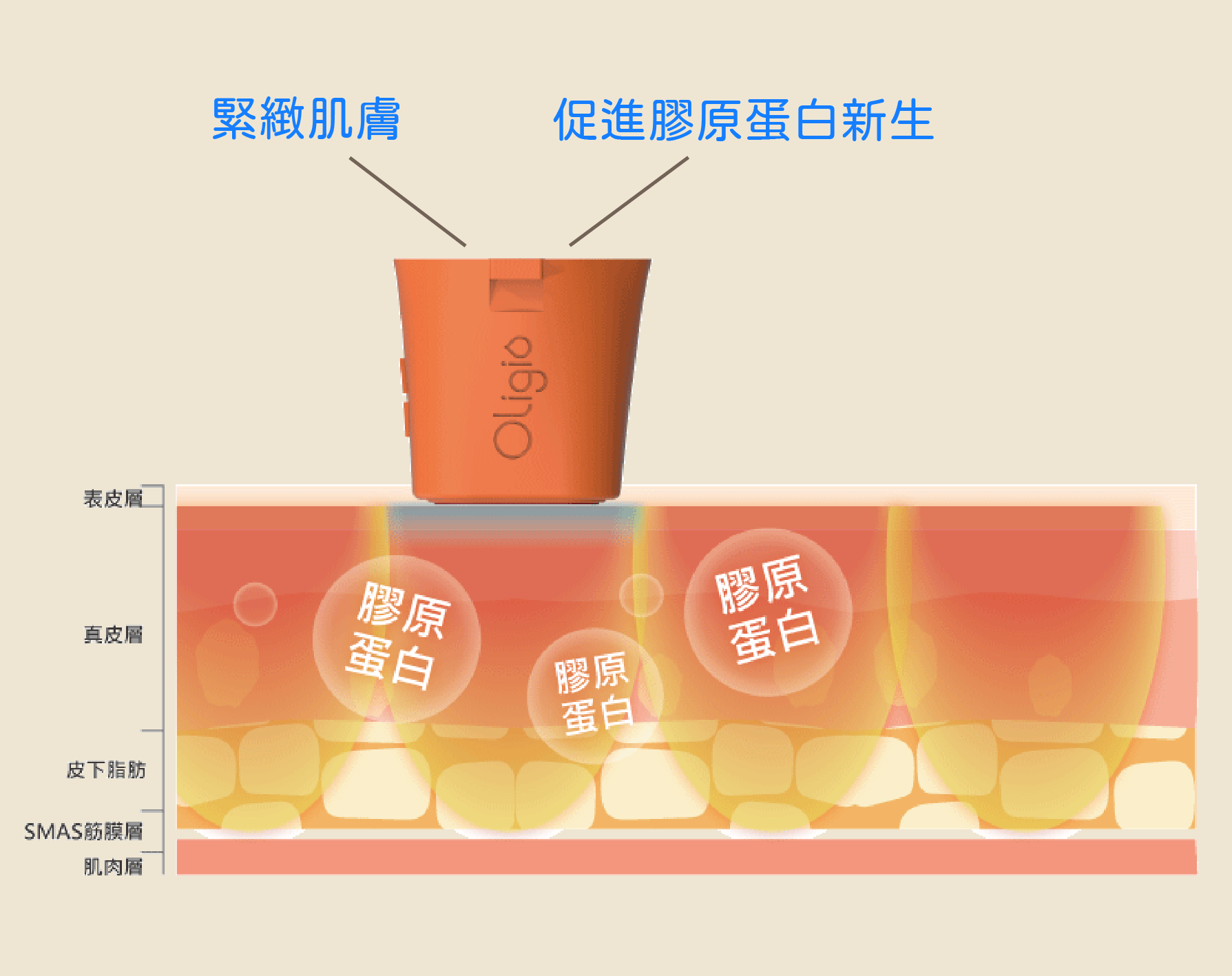 玩美電波-完美電波拉皮